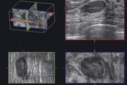 GE Ultrasound